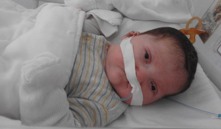 Paula Michiu, bebeluşul care s-a născut cu o malformaţie la nivelul gurii