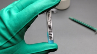 3.240 infectări cu SARS – CoV – 2, dar s-au făcut puține teste