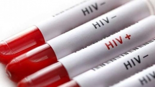 Alarmant! 11 cazuri noi de HIV la Constanța. Cum este posibil?!