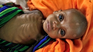 Ar trebui să fie alarmă mondială! Stare de foamete în Sudanul de Sud!