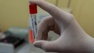 Peste 1.000 persoane infectate cu Covid-19 în acest an în județul Constanța. Care este situația privind coronavirusul