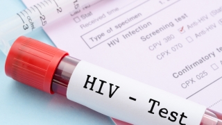 „Ești negatHIV? Testează-te și fii sigur!“