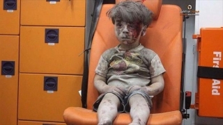 Fotografia „băieţelului din ambulanţă“ face din nou înconjurul lumii