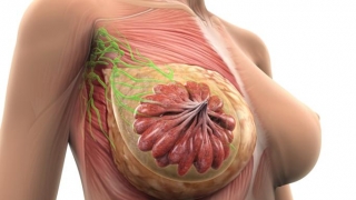 Femeile care au sâni cu densitate mare sunt mai expuse cancerului