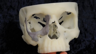 Imprimantă 3D destinată producerii de organe
