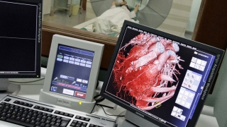 Inimă artificială siberiană, mai ieftină și mai rezistentă