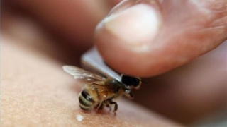 Înţepătura de albină poate fi mortală. Acum există un ser terapeutic...