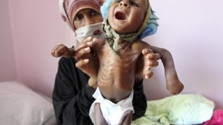 În Yemen, un copil moare la 10 minute de foame - UNICEF