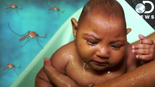 Pentru prima oară se asociază Zika cu deformarea articulațiilor la nou-născuți