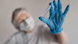 Primul caz de variola maimuței confirmat în România