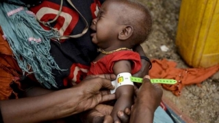 Există riscul unui număr mare de decese în Africa din cauza foametei