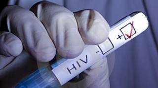 A fost lansată campania „Ești negatHIV? Testează-te și fii sigur!“