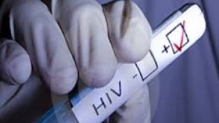 Streinu-Cercel: Infecţia cu HIV poate fi ţinută sub control