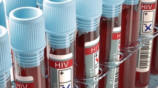 Constanţa: cele mai multe cazuri de HIV/SIDA! Hepatita, HIV/SIDA, testate obligatoriu!
