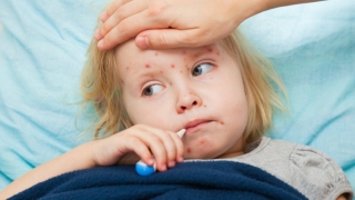 Rujeola face victime! Ministerul Sănătății cere vaccinare de la 9 luni