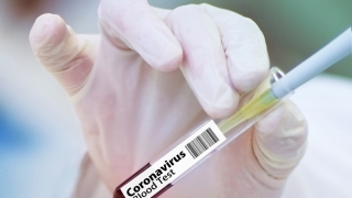 Coronavirus: Vaccinul rusesc produce anticorpi