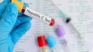 Veşti importante pentru bolnavii de hepatită cronică virală C
